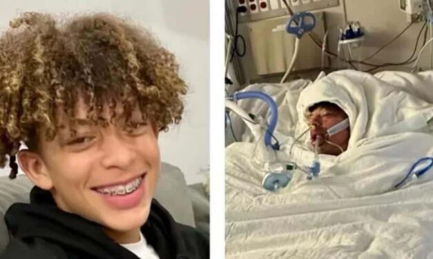 Desafío de TikTok deja a un adolescente desfigurado con casi el 80 % del cuerpo quemado