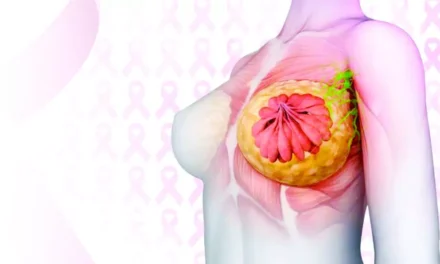 Cáncer de mama: identificarlo a tiempo puede salvar vidas